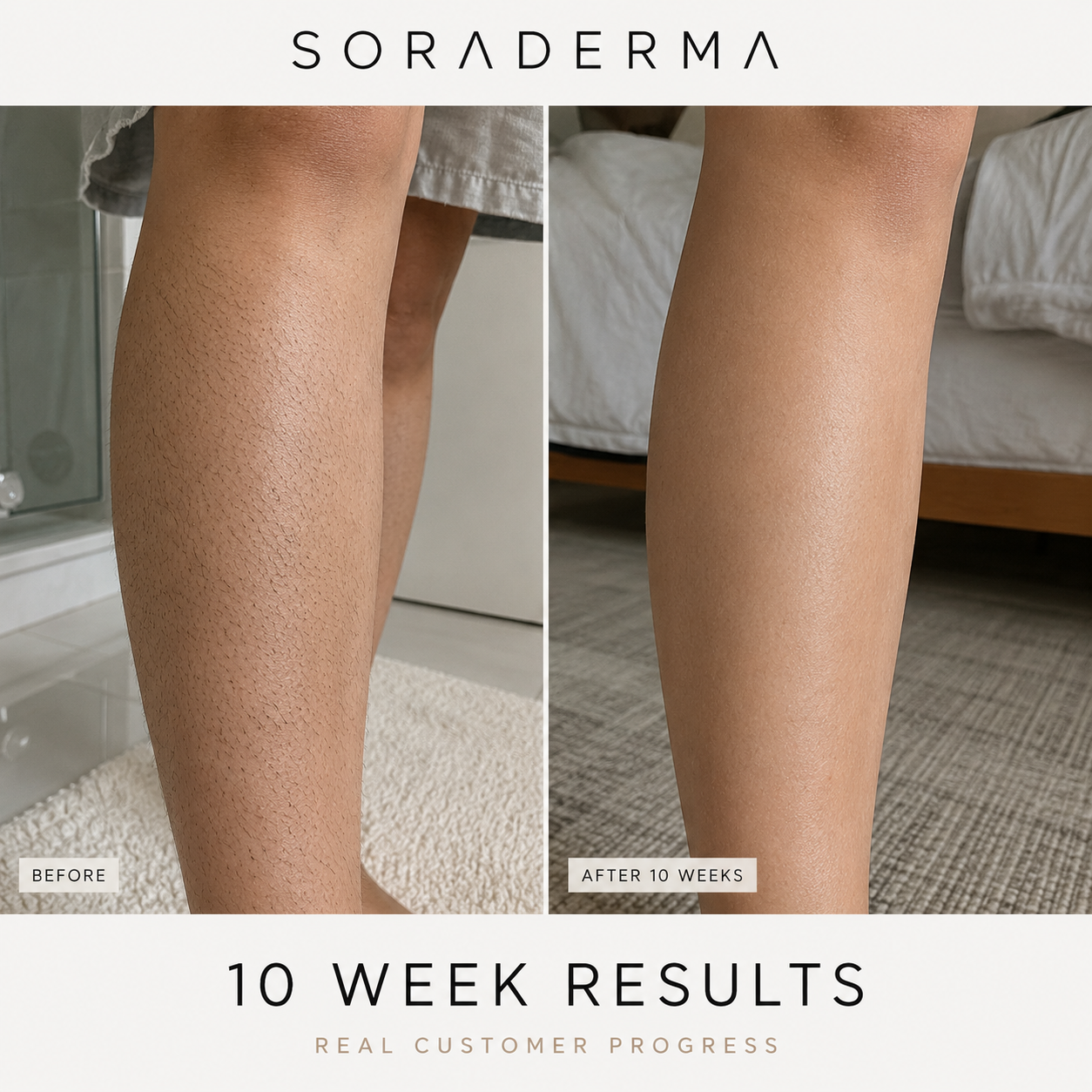 Leg before and after