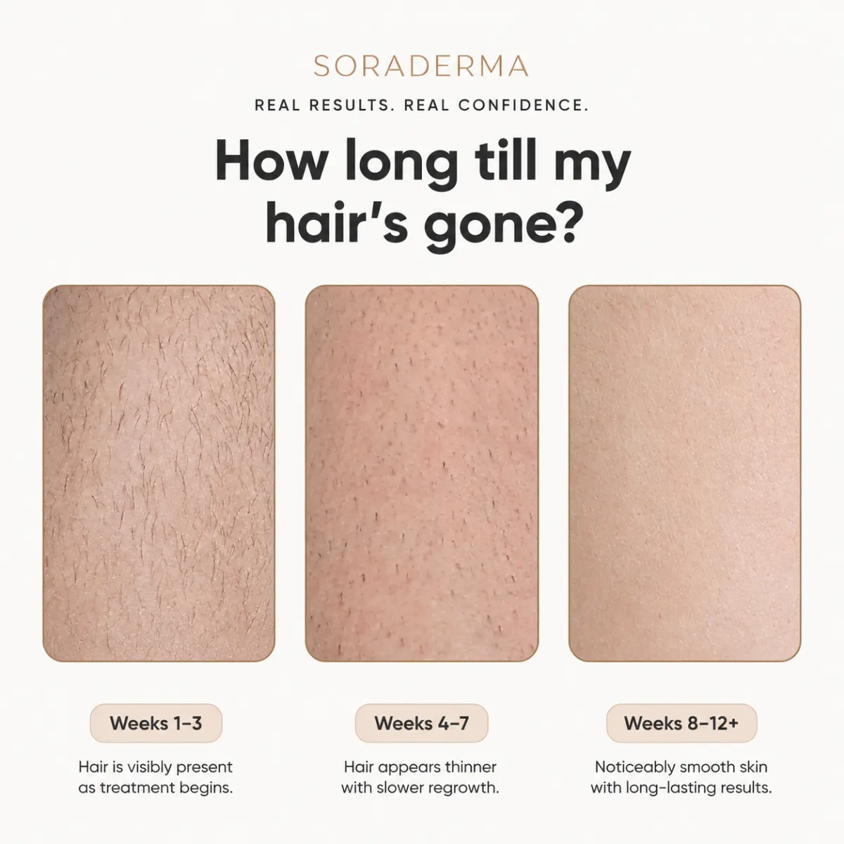 Soraderma results timeline: weeks 1-3, 4-7, and 8-12+