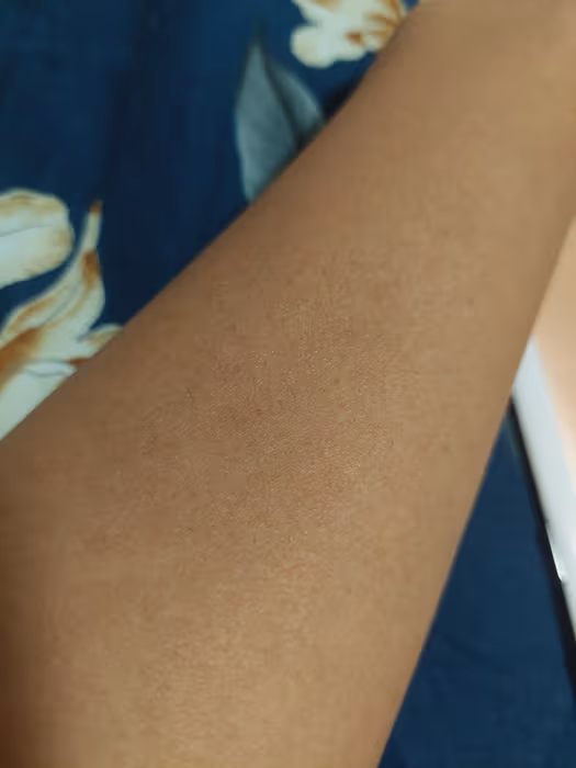 Legs after 6 weeks