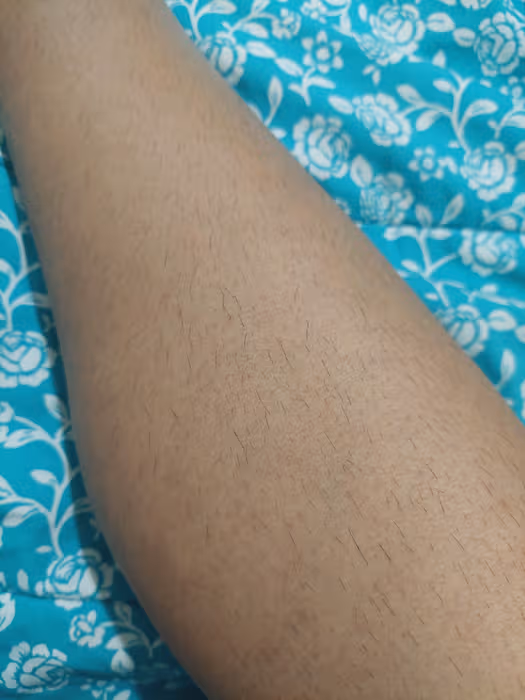 Legs before treatment
