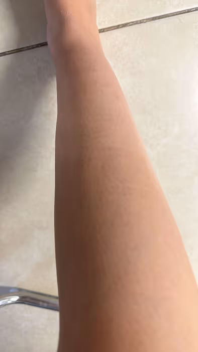 Legs after 7 weeks