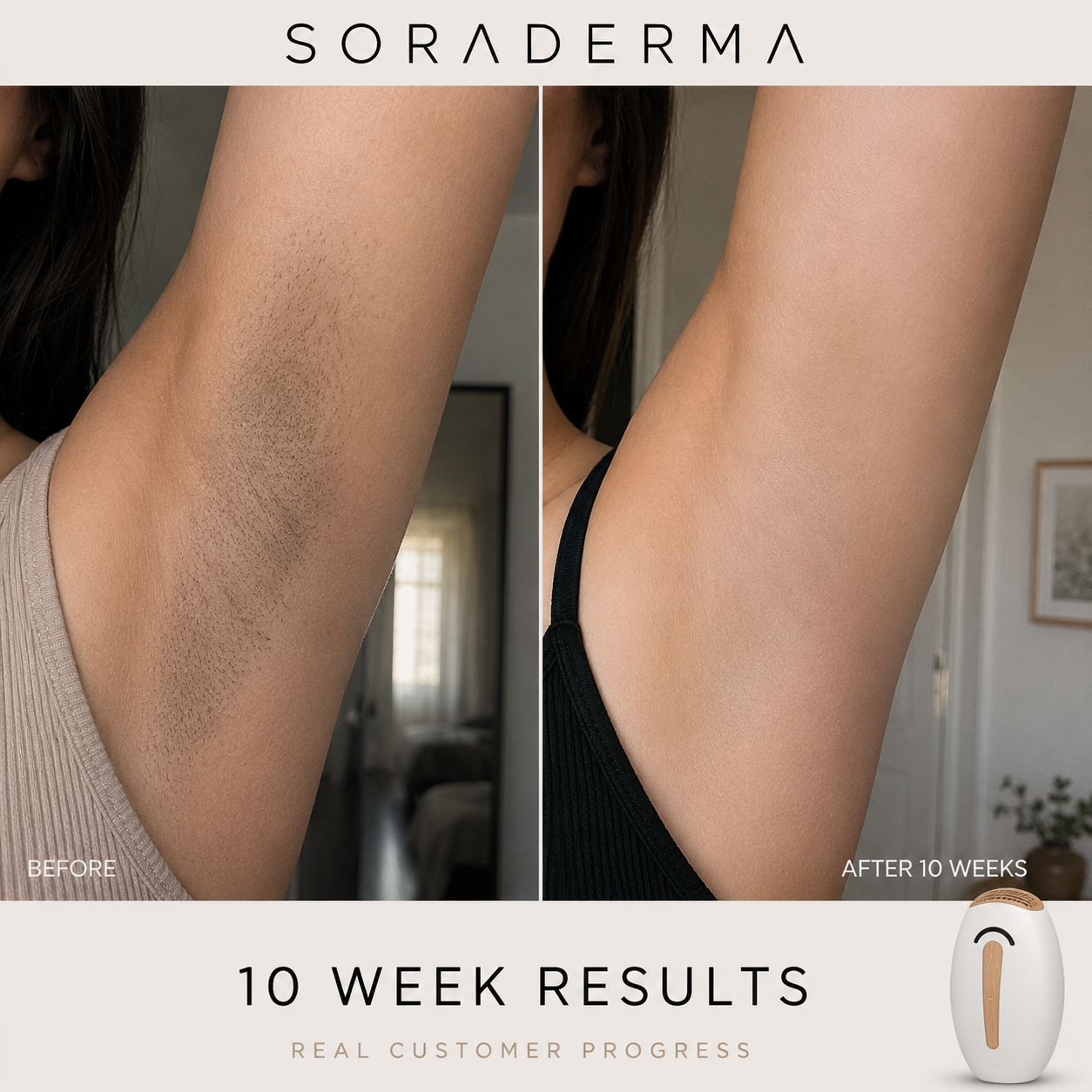 Underarm before and after